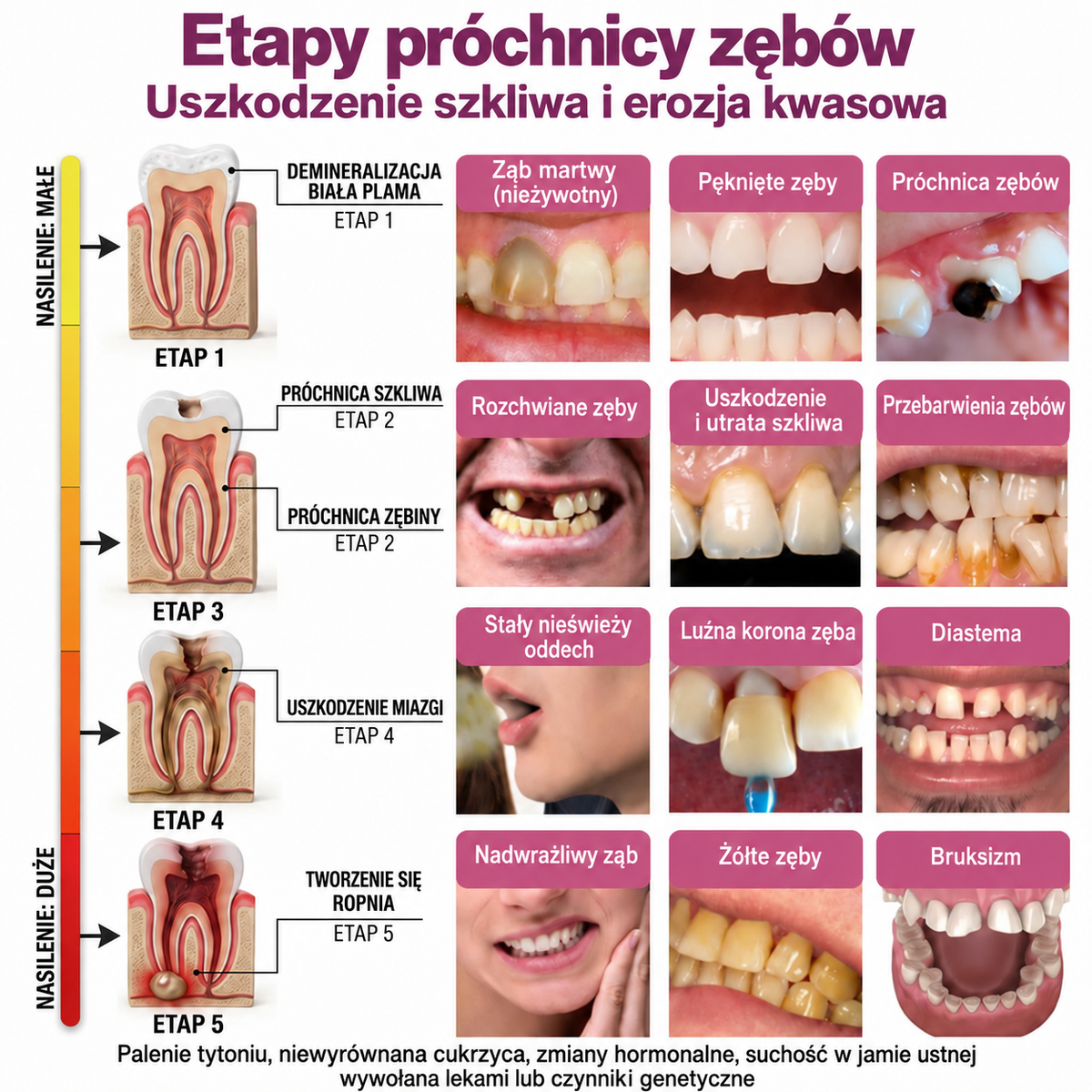 🇵🇱 Rolimey® DenPerm – Naturalny żel do odbudowy szkliwa i wypełniania ubytków