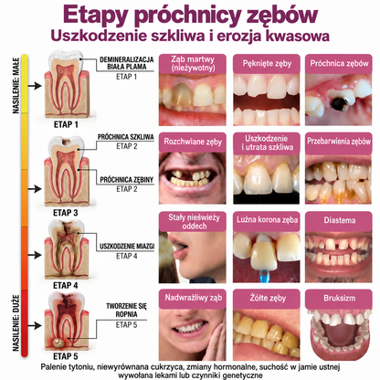 🇵🇱 Rolimey® DenPerm – Naturalny żel do odbudowy szkliwa i wypełniania ubytków