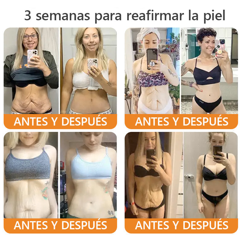 Hecho y enviado desde México🇲🇽👉|AWZLOVE® Crema Integral de Veneno de Abeja🤲| ¡ÚLTIMO DÍA con 80% de DESCUENTO! 🤲
