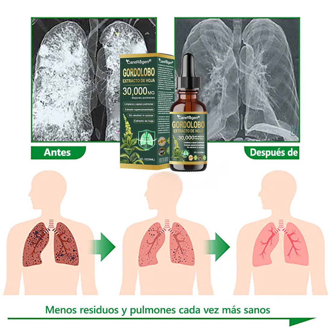 𝗧𝗶𝗲𝗻𝗱𝗮 𝗢𝗳𝗶𝗰𝗶𝗮𝗹: 𝗖𝗮𝗿𝗲𝗥𝗲𝗴𝗲𝗻® 𝗘𝘅𝘁𝗿𝗮𝗰𝘁𝗼 𝗢𝗿𝗴á𝗻𝗶𝗰𝗼 𝗱𝗲 𝗛𝗼𝗷𝗮 𝗱𝗲 𝗚𝗼𝗿𝗱𝗼𝗹𝗼𝗯𝗼 𝗽𝗮𝗿𝗮 𝗟𝗶𝗺𝗽𝗶𝗲𝘇𝗮 𝗣𝘂𝗹𝗺𝗼𝗻𝗮𝗿 𝐅ó𝐫𝐦𝐮𝐥𝐚 𝐜𝐥í𝐧𝐢𝐜𝐚𝐦𝐞𝐧𝐭𝐞 𝐩𝐫𝐨𝐛𝐚𝐝𝐚 𝐲 𝐚𝐥𝐭𝐚𝐦𝐞𝐧𝐭𝐞 𝐜𝐨𝐧𝐜𝐞𝐧𝐭𝐫𝐚𝐝𝐚 𝐪𝐮𝐞 𝐚𝐲𝐮𝐝𝐚 𝐚 𝐚𝐥𝐢𝐯𝐢𝐚𝐫 𝐥𝐚 𝐭𝐨𝐬, 𝐥𝐚 𝐟𝐥𝐞𝐦𝐚, 𝐞𝐥 𝐚𝐬𝐦𝐚 𝐲 𝐥𝐚 𝐂𝐎𝐏𝐃 — 💧𝐫𝐞𝐬𝐩𝐢𝐫𝐚 𝐦𝐞𝐣𝐨𝐫, 𝐦á𝐬 𝐫á𝐩𝐢𝐝𝐨.💧