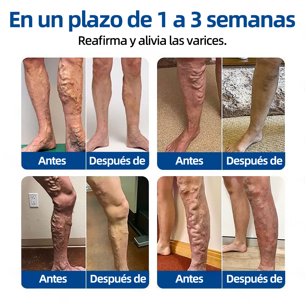 𝗛𝗲𝗮𝗹𝗿𝗶𝘇𝗲® 𝗣𝗮𝗿𝗰𝗵𝗲 𝗠𝗶𝗰𝗿𝗼𝗻𝗲𝗲𝗱𝗹𝗲 𝗩𝗲𝗶𝗻𝗧𝗮𝗿𝗴𝗲𝘁 𝗔𝗹𝗶𝘃𝗶𝗼 𝗜𝗻𝘀𝘁𝗮𝗻𝘁𝗮́𝗻𝗲𝗼, 𝗥𝗲𝘀𝘂𝗹𝘁𝗮𝗱𝗼𝘀 𝗮 𝗟𝗮𝗿𝗴𝗼 𝗣𝗹𝗮𝘇𝗼🌾🌻🇪🇸