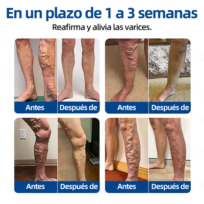 𝗛𝗲𝗮𝗹𝗿𝗶𝘇𝗲® 𝗣𝗮𝗿𝗰𝗵𝗲 𝗠𝗶𝗰𝗿𝗼𝗻𝗲𝗲𝗱𝗹𝗲 𝗩𝗲𝗶𝗻𝗧𝗮𝗿𝗴𝗲𝘁 𝗔𝗹𝗶𝘃𝗶𝗼 𝗜𝗻𝘀𝘁𝗮𝗻𝘁𝗮́𝗻𝗲𝗼, 𝗥𝗲𝘀𝘂𝗹𝘁𝗮𝗱𝗼𝘀 𝗮 𝗟𝗮𝗿𝗴𝗼 𝗣𝗹𝗮𝘇𝗼🌾🌻🇪🇸