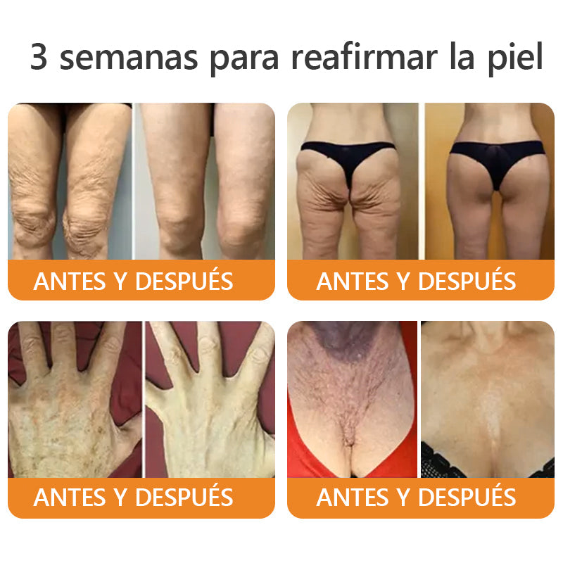Hecho y enviado desde México🇲🇽👉|AWZLOVE® Crema Integral de Veneno de Abeja🤲| ¡ÚLTIMO DÍA con 80% de DESCUENTO! 🤲