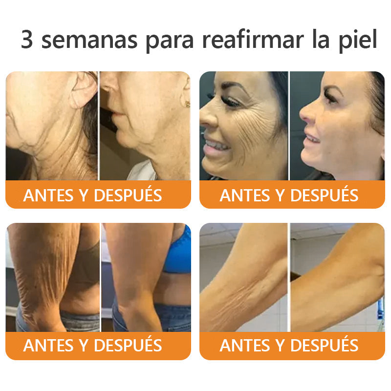 Hecho y enviado desde México🇲🇽👉|AWZLOVE® Crema Integral de Veneno de Abeja|🐅 ¡ÚLTIMO DÍA con 80% de DESCUENTO! 🐅